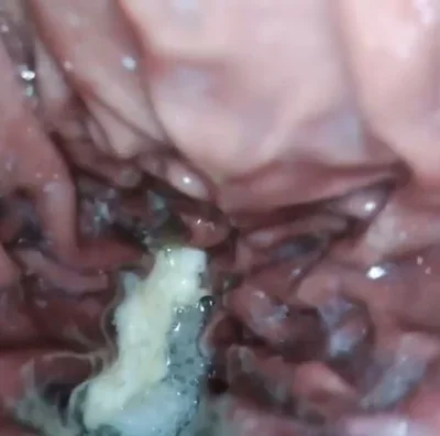 Inside a Stomach
